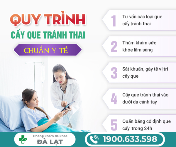 Hình ảnh minh họa